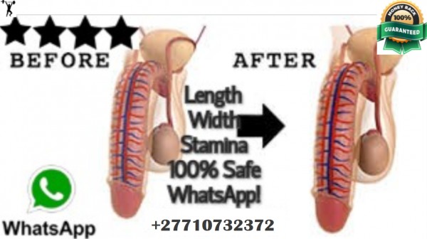 Men's Clinic International For Penis Enlargement In Grodno City in Belarus Call +27710732372 In Mossel Bay Town in South Africa