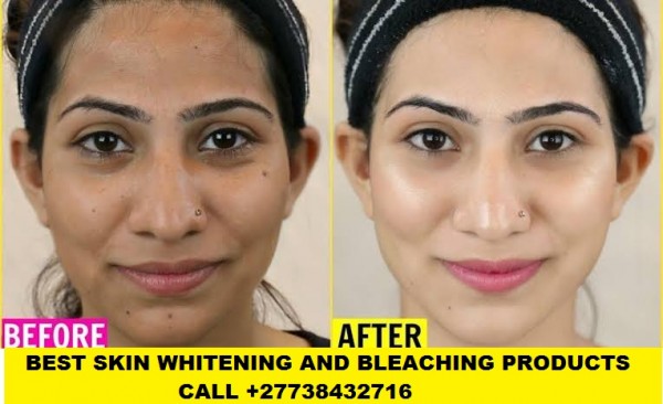 BEST SKIN WHITENING AND BLEACHING PRODUCTS CALL +27738432716